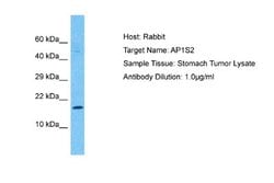 AP1S2 Antibody, Novus Biologicals 100 &mu;L | Buy Online | Novus Biologicals | Fisher Scientific